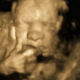 Illustration for article titled Gah! 3D Ultrasound Nightmare Fuel!